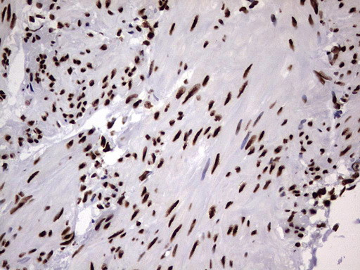 HNRNPM Antibody in Immunohistochemistry (Paraffin) (IHC (P))