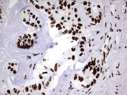 HNRNPM Antibody in Immunohistochemistry (Paraffin) (IHC (P))