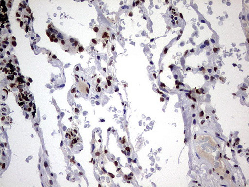 HNRNPM Antibody in Immunohistochemistry (Paraffin) (IHC (P))