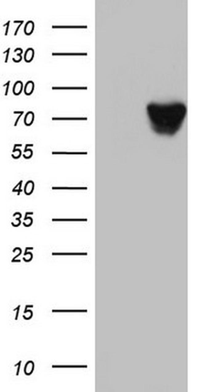 HNRNPM Antibody in Western Blot (WB)