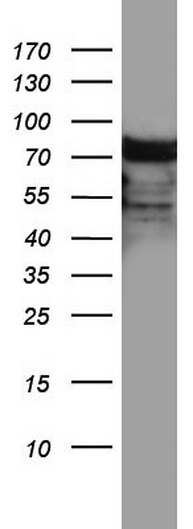 HNRNPM Antibody in Western Blot (WB)