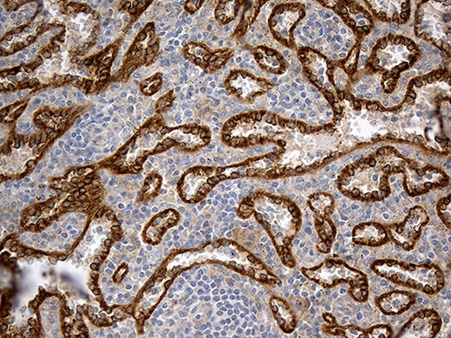 HOMER1 Antibody in Immunohistochemistry (Paraffin) (IHC (P))