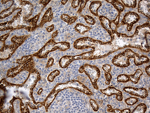 HOMER1 Antibody in Immunohistochemistry (Paraffin) (IHC (P))