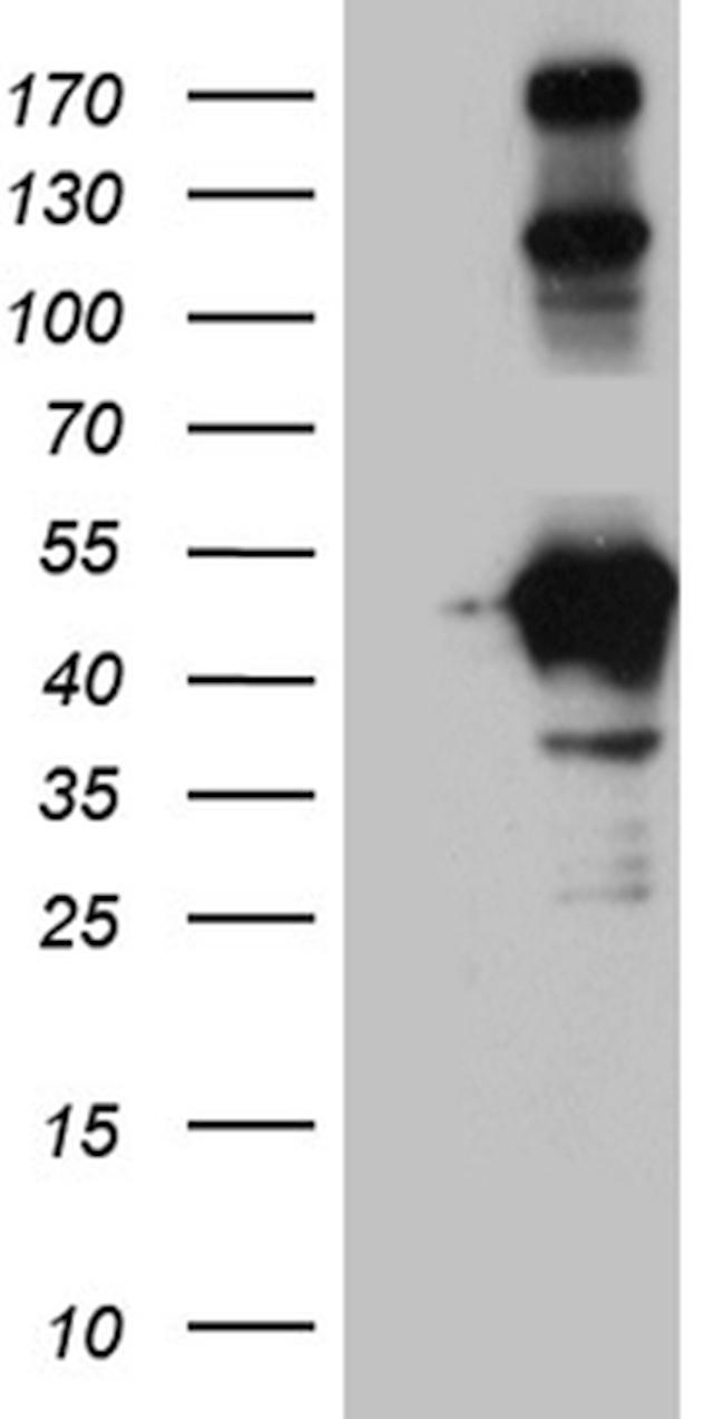 HOMER1 Antibody in Western Blot (WB)