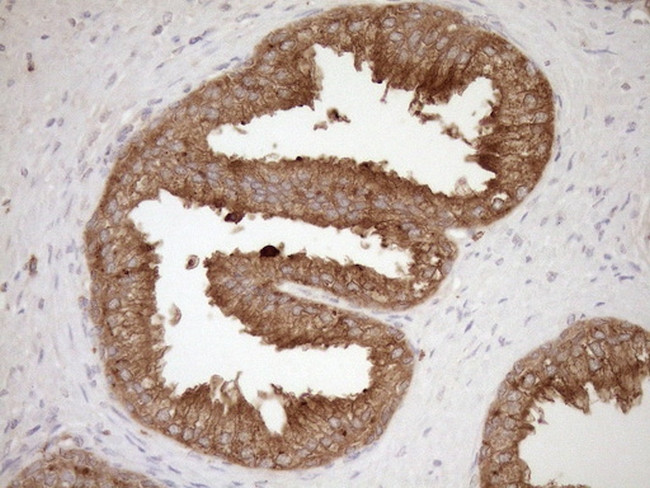 HOXC10 Antibody in Immunohistochemistry (Paraffin) (IHC (P))