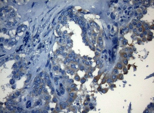 HOXC10 Antibody in Immunohistochemistry (Paraffin) (IHC (P))