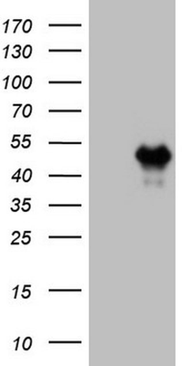 HOXC10 Antibody in Western Blot (WB)