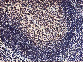 HOXC11 Antibody in Immunohistochemistry (Paraffin) (IHC (P))