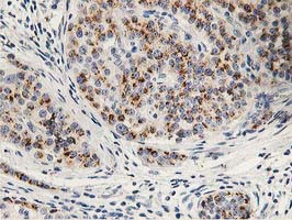 HOXC11 Antibody in Immunohistochemistry (Paraffin) (IHC (P))