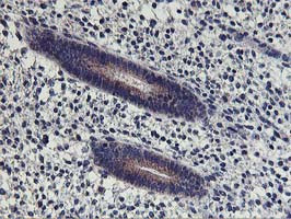 HOXC11 Antibody in Immunohistochemistry (Paraffin) (IHC (P))