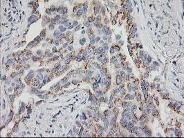 HOXC11 Antibody in Immunohistochemistry (Paraffin) (IHC (P))