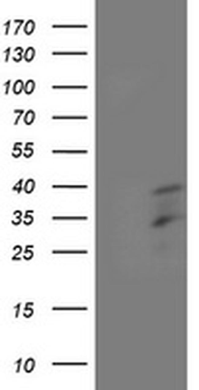 HOXC11 Antibody in Western Blot (WB)