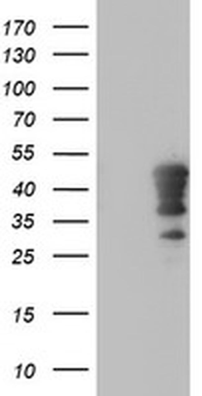 HOXC11 Antibody in Western Blot (WB)