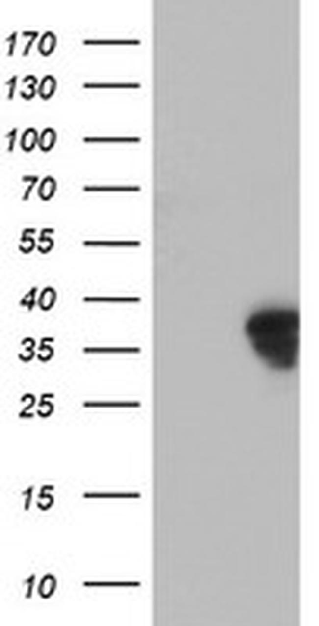 HOXC11 Antibody in Western Blot (WB)