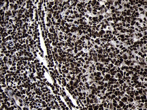 HOXC4 Antibody in Immunohistochemistry (Paraffin) (IHC (P))