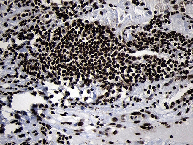 HOXC4 Antibody in Immunohistochemistry (Paraffin) (IHC (P))