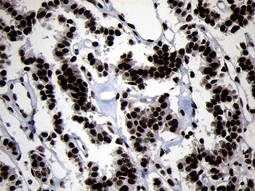 HOXC4 Antibody in Immunohistochemistry (Paraffin) (IHC (P))