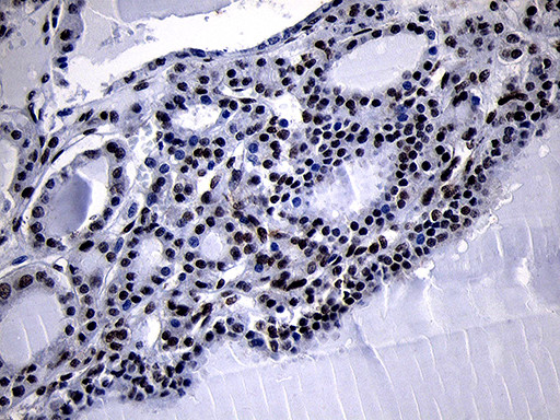 HOXC4 Antibody in Immunohistochemistry (Paraffin) (IHC (P))