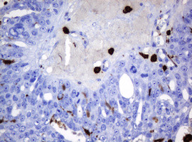 HOXD10 Antibody in Immunohistochemistry (Paraffin) (IHC (P))