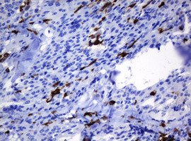 HOXD10 Antibody in Immunohistochemistry (Paraffin) (IHC (P))