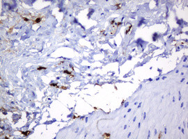 HOXD10 Antibody in Immunohistochemistry (Paraffin) (IHC (P))