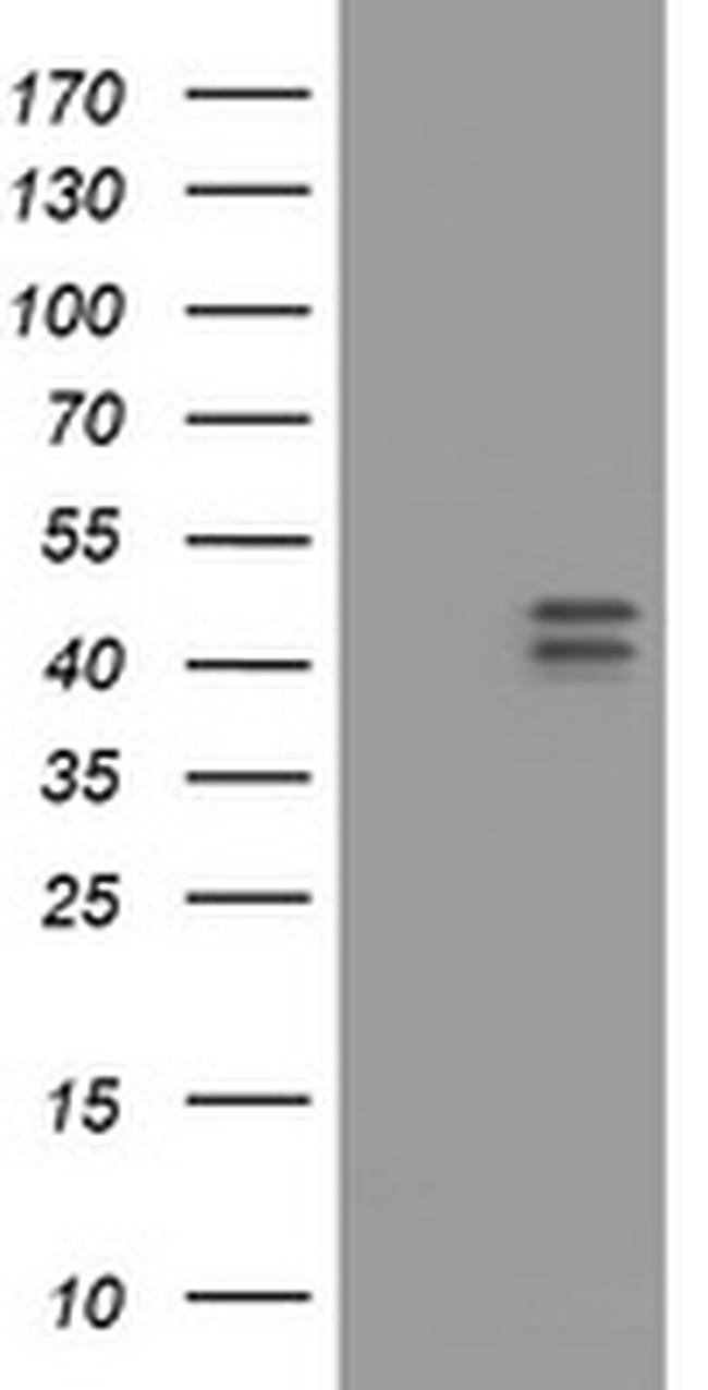 HOXD10 Antibody in Western Blot (WB)