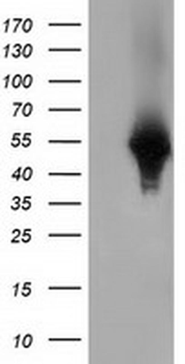 HP Antibody in Western Blot (WB)