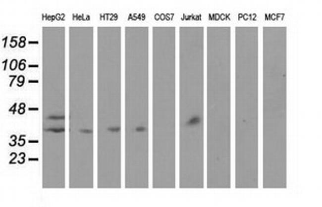 HP Antibody in Western Blot (WB)