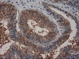 HPGD Antibody in Immunohistochemistry (Paraffin) (IHC (P))