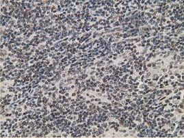 HPGD Antibody in Immunohistochemistry (Paraffin) (IHC (P))