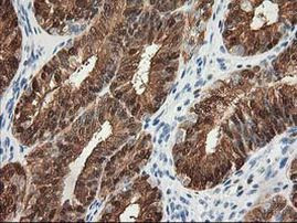 HPGD Antibody in Immunohistochemistry (Paraffin) (IHC (P))