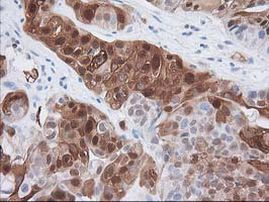 HPGD Antibody in Immunohistochemistry (Paraffin) (IHC (P))