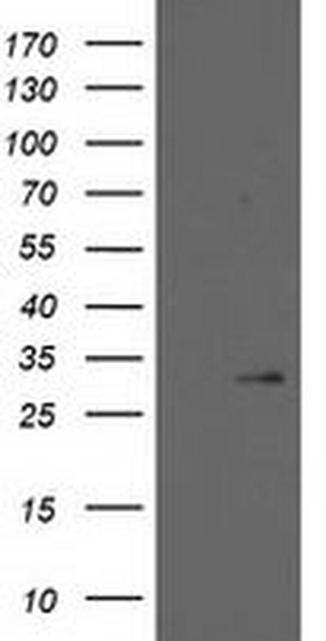 HPGD Antibody in Western Blot (WB)