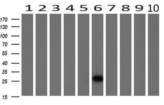 HPGD Antibody in Western Blot (WB)