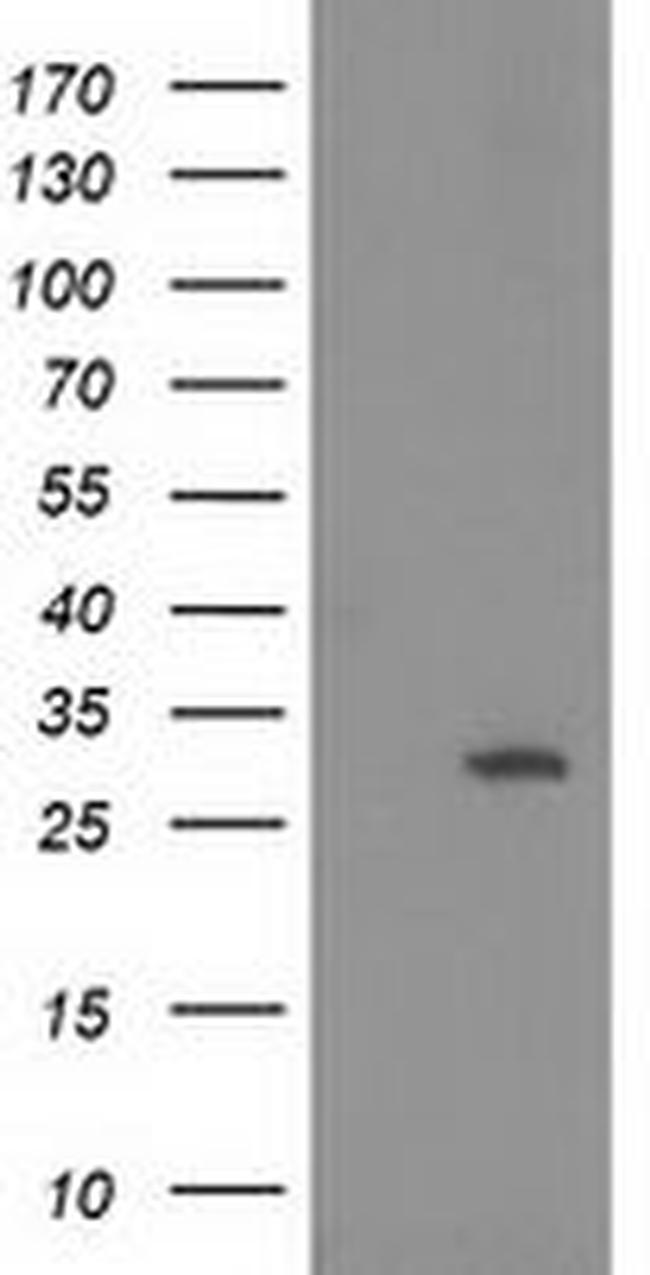 HPGD Antibody in Western Blot (WB)