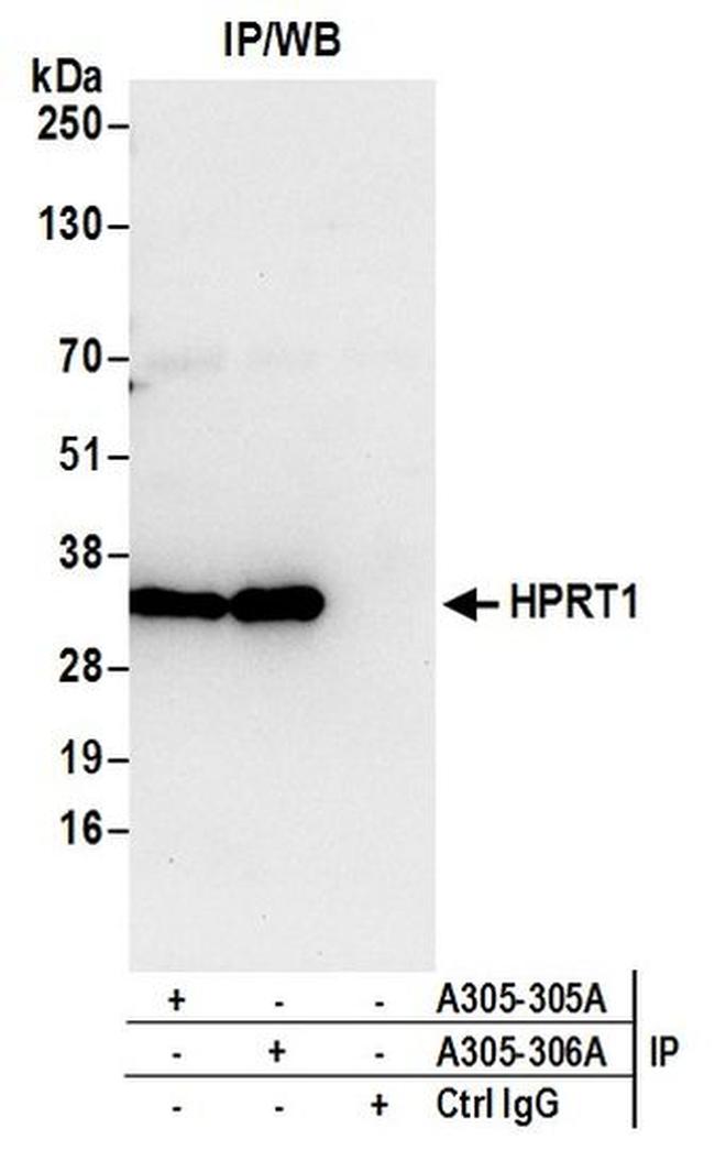 HPRT1 Antibody in Western Blot (WB)