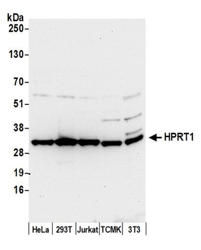 HPRT1 Antibody in Western Blot (WB)