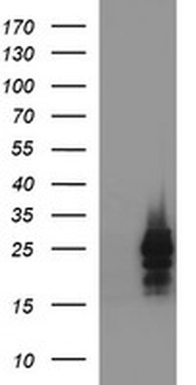 HPRT1 Antibody in Western Blot (WB)