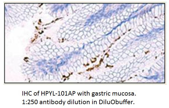 Helicobacter pylori Antibody in Immunohistochemistry (IHC)