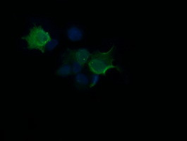 HRAS Antibody in Immunocytochemistry (ICC/IF)