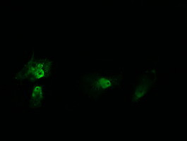 HRAS Antibody in Immunocytochemistry (ICC/IF)