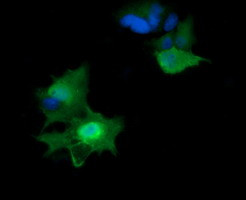 HRAS Antibody in Immunocytochemistry (ICC/IF)