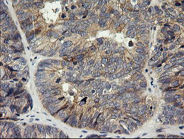 HRAS Antibody in Immunohistochemistry (Paraffin) (IHC (P))