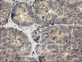 HRAS Antibody in Immunohistochemistry (Paraffin) (IHC (P))