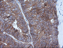 HRAS Antibody in Immunohistochemistry (Paraffin) (IHC (P))