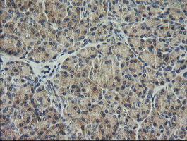 HRAS Antibody in Immunohistochemistry (Paraffin) (IHC (P))