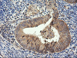 HRAS Antibody in Immunohistochemistry (Paraffin) (IHC (P))