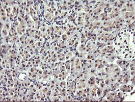 HRAS Antibody in Immunohistochemistry (Paraffin) (IHC (P))