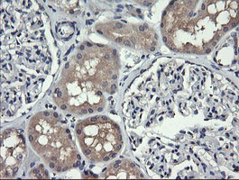 HRAS Antibody in Immunohistochemistry (Paraffin) (IHC (P))