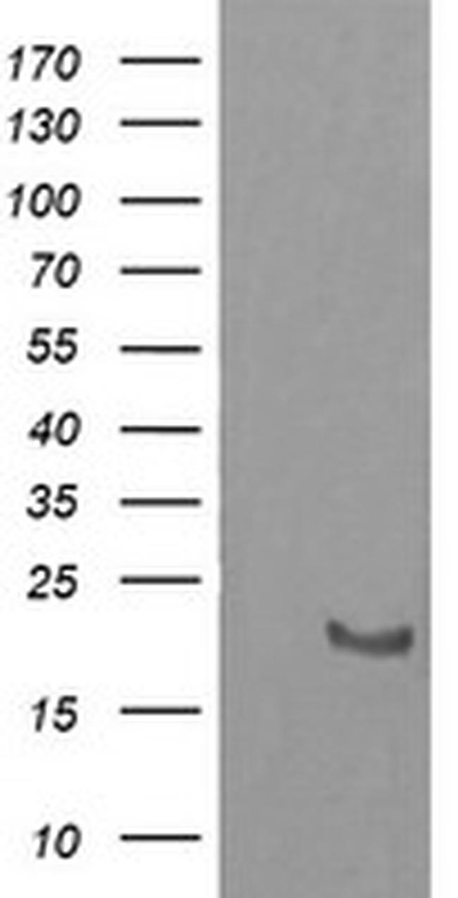 HRAS Antibody in Western Blot (WB)